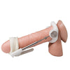 Jes Extender Titanium Penis Enlarger Kit